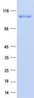 Mouse MALT1 Protein (Recombinant Myc-DDK (Flag), C-terminus)