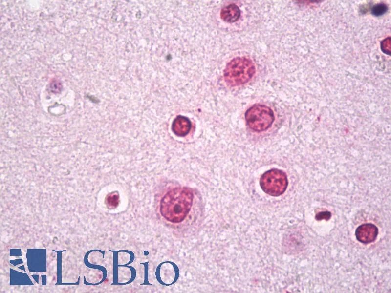 IHC-plus™ BACH2 Antibody (Internal)