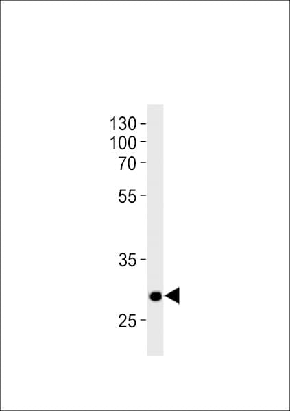 HOXD9 Antibody (aa234-260)