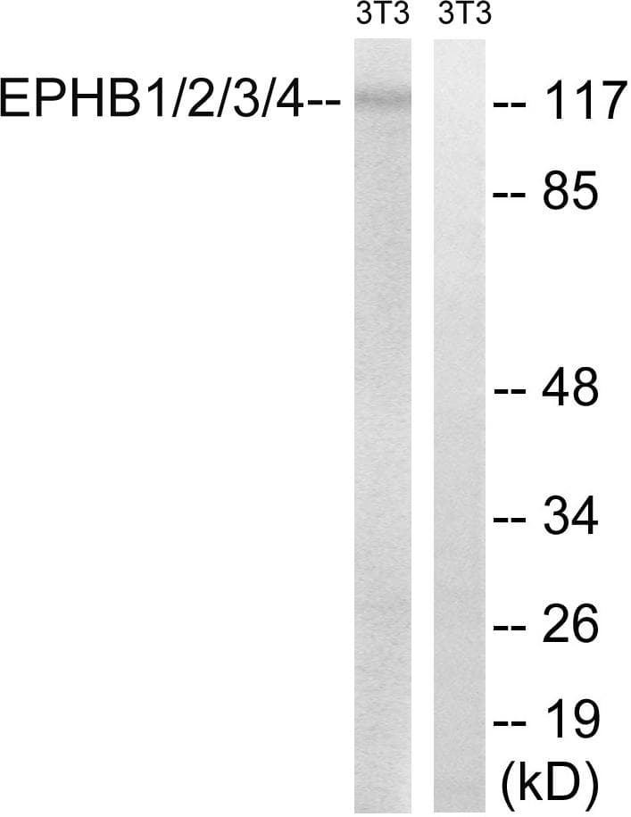 EPHB1 + EPHB2 + EPHB3 + EPHB4 Antibody (p600/602/614/596)