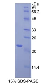 Mouse TLR3 Protein (Recombinant His)