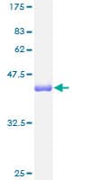 Human TNNC1 / Cardiac Troponin C Protein (Recombinant GST)