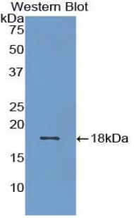 BMP15 Antibody (aa269-391, APC, Cy7)