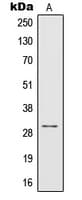 Polyclonal Rabbit anti-Human IL-1B / IL-1 Beta Antibody (Internal, IHC, WB)