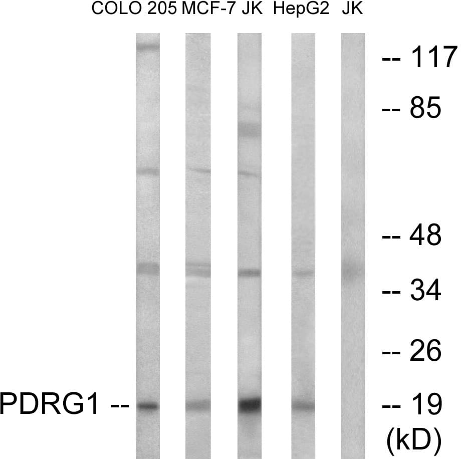 PDRG1 Antibody (aa58-107)