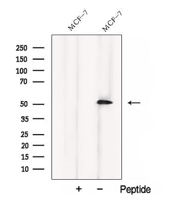 Polyclonal Rabbit anti-Human CCM2 / Malcavernin Antibody (WB)