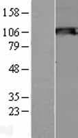 SIK2 / SNF1LK2 Protein (Over-Expression Lysate Myc-DDK (Flag))