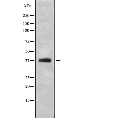 B4GALT7 Antibody