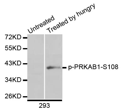 Polyclonal Rabbit anti-Human PRKAB1 / AMPK Beta 1 Antibody (phospho-Ser108, WB)
