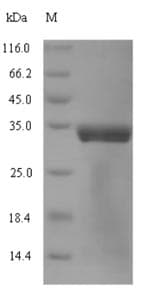 Mycoplasma pneumoniae dnaK Protein (Recombinant 6His-SUMO, N-terminus)