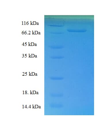 Human DOK1 Protein (Recombinant His-SUMO)
