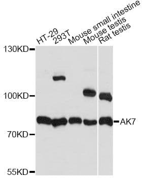 AK7 / Adenylate Kinase 7 Antibody