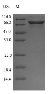 Mouse GPI Protein (Recombinant 6His-B2M, N-terminus)