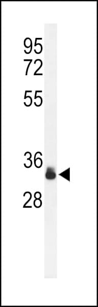 Sprouty 4 / SPRY4 Antibody (aa26-56)