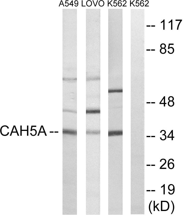 CA5A / Carbonic Anhydrase VA Antibody