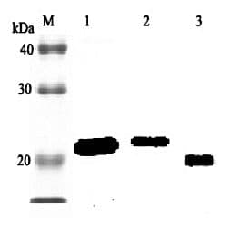 RBP4 Antibody (Biotin)