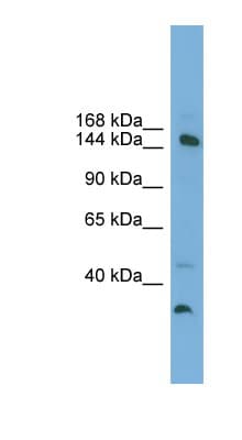 Polyclonal Rabbit anti-Human MED14 Antibody (aa575-624, WB)