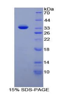 Mouse PTPRJ / CD148 Protein (Recombinant His-T7)