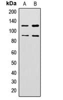 Polyclonal Rabbit anti-Human ZNF148 / ZBP-89 Antibody (N-Terminus, IHC, IF, WB)