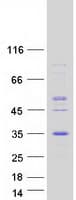 Human MAGP / MFAP2 Protein (Recombinant Myc-DDK (Flag))