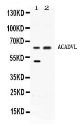 ACADVL Antibody