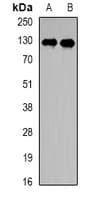 PPP6R2 / SAPS2 Antibody