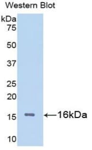 LGALS1 / Galectin 1 Antibody (aa1-135, APC)