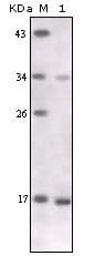 TNF Alpha Antibody (clone 2A9B9)