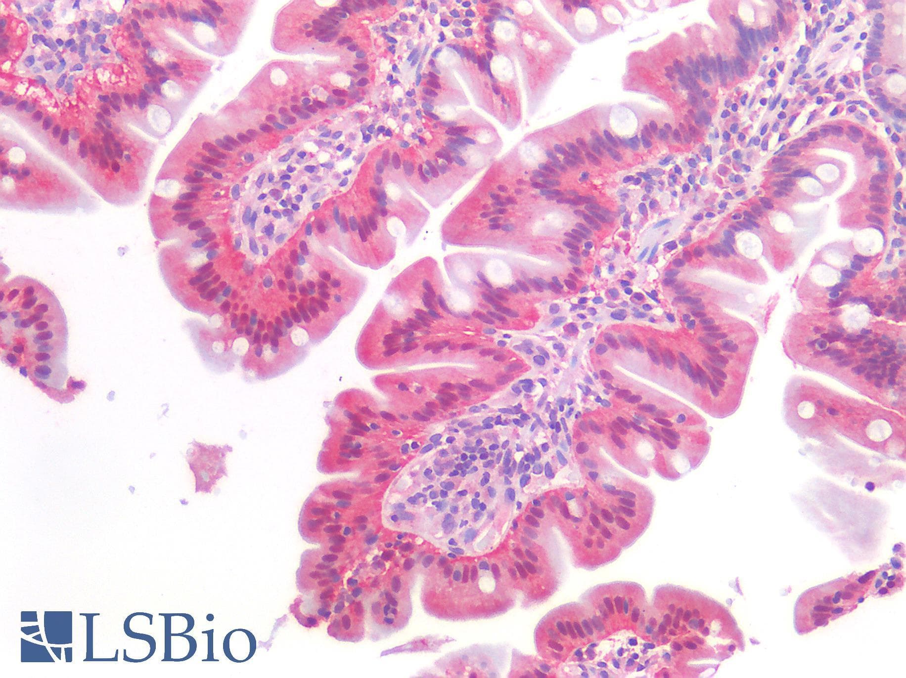 IHC-plus™ ERBB3 / HER3 Antibody