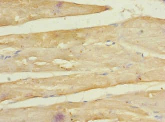 FZD3 / Frizzled 3 Antibody