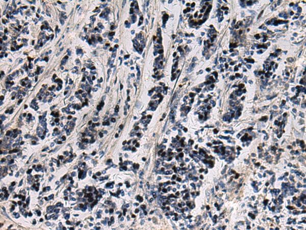 SNIP1 Antibody