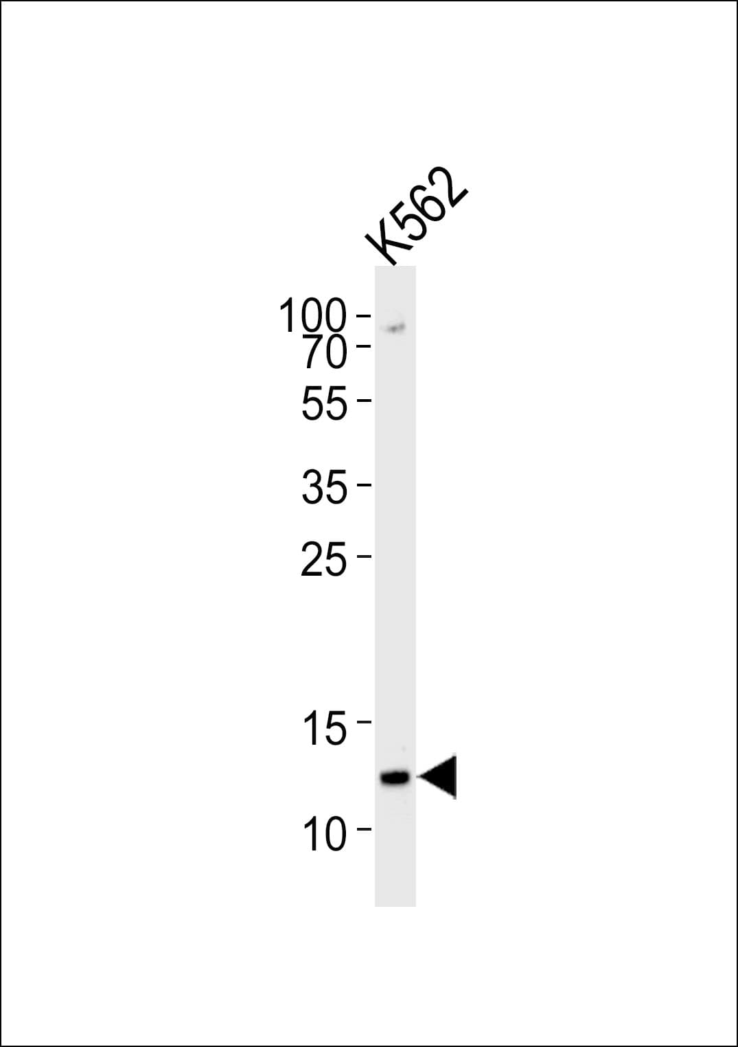 Histone H4 Antibody (aa1-30)