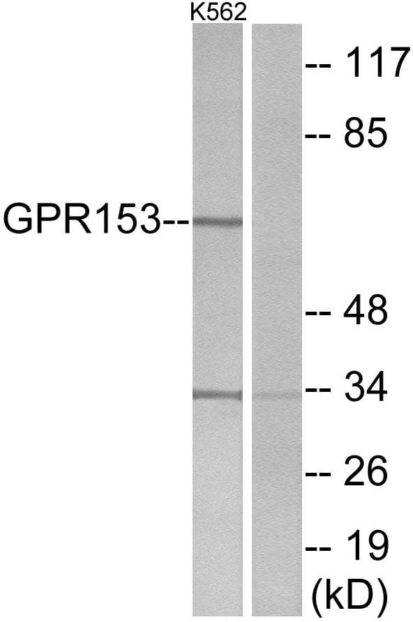 PGR1 / GPR153 Antibody