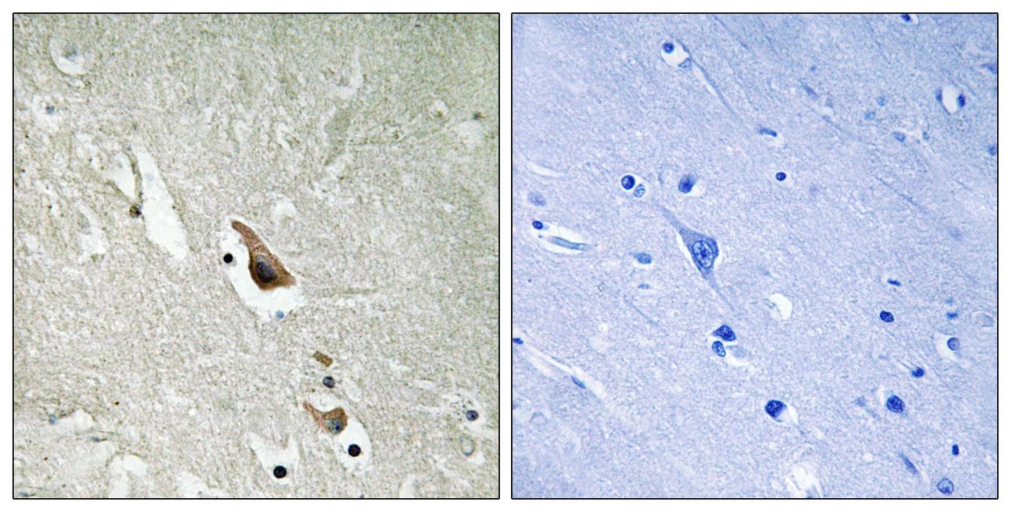 MAP3K7 / TAK1 Antibody (phospho-Ser439)