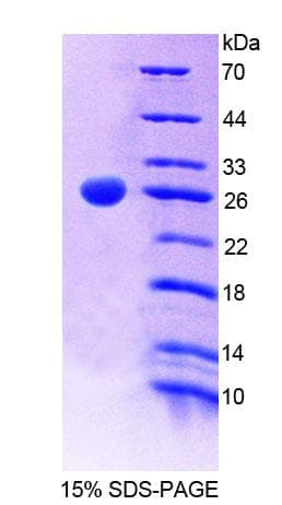 Human SMMHC / MYH11 Protein (Recombinant His-T7, N-terminus)
