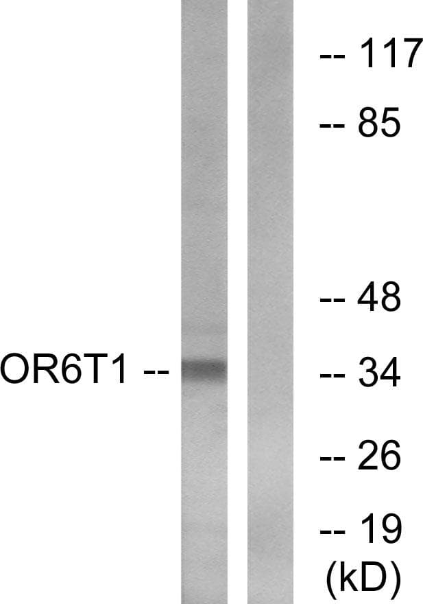 OR6T1 Antibody