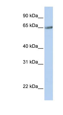 TM9SF1 Antibody (aa144-193)