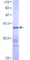 Human EXO1 Protein (Recombinant GST, N-terminus)