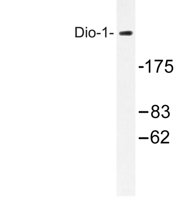 Polyclonal Rabbit anti-Human DATF1 / DIDO1 Antibody (Ser186, IHC, WB)