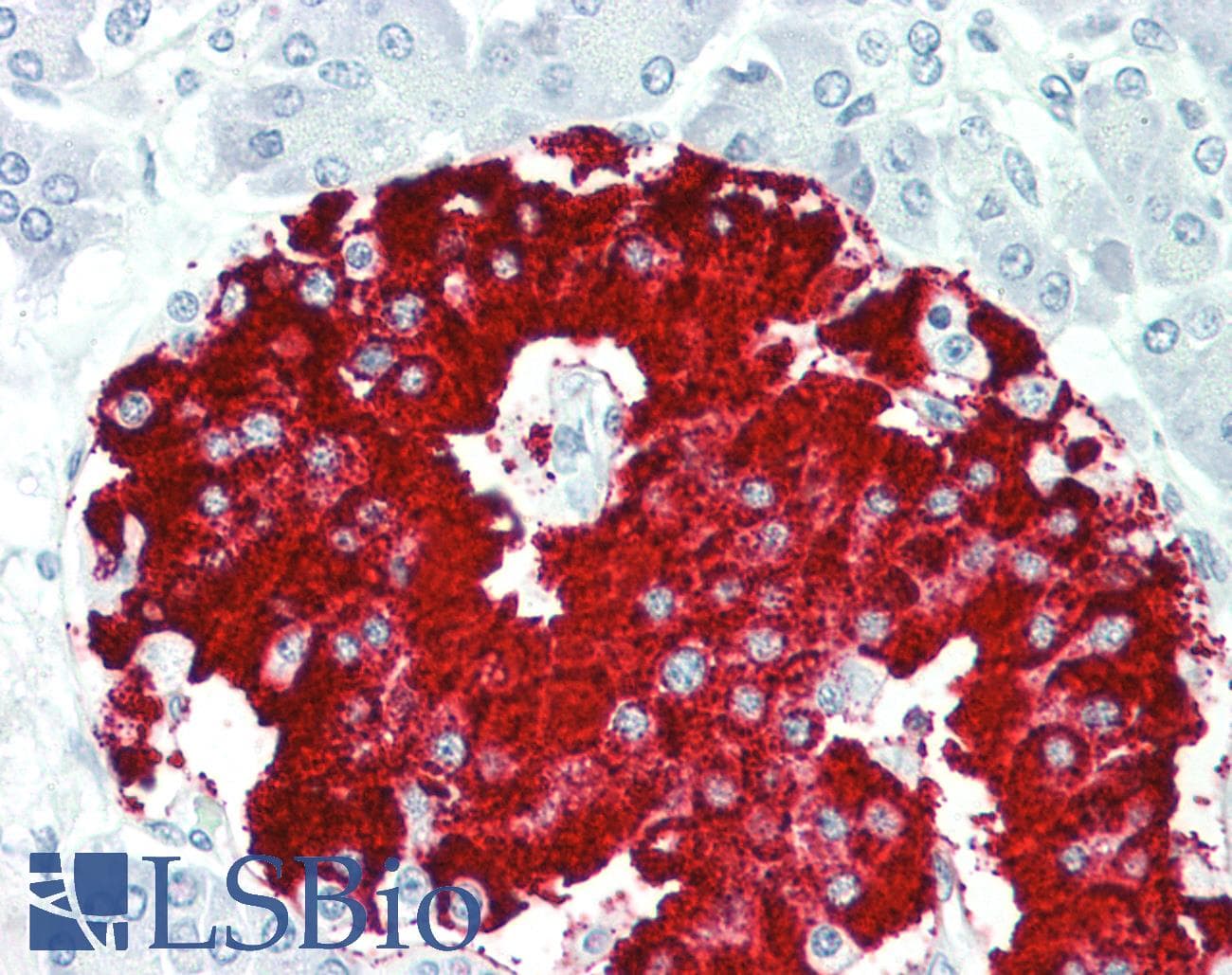 Polyclonal Rabbit anti-Human RBFOX1 / A2BP1 Antibody (aa81-130, IHC, WB)