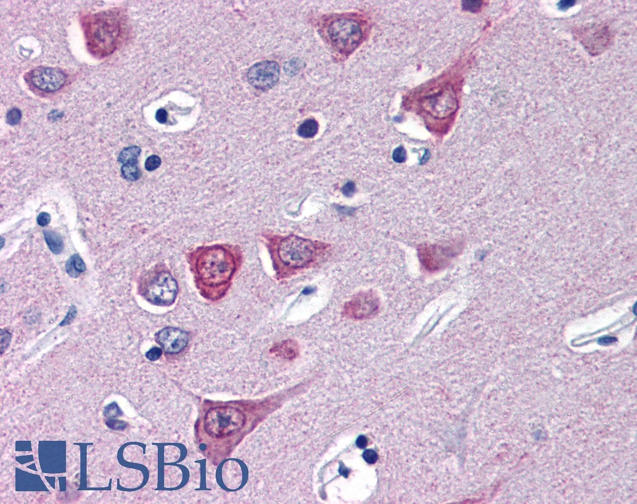 IHC-plus™ Polyclonal Rabbit anti-Human SOCS1 Antibody (IHC, WB)