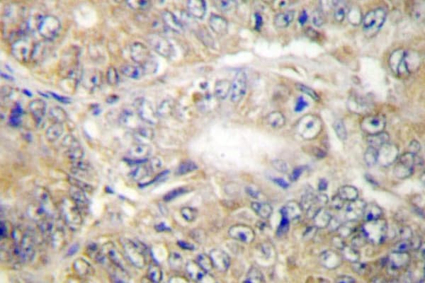 Polyclonal Rabbit anti-Human TNFSF13 / APRIL Antibody (Ser183, IHC, IF, WB)
