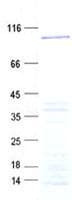 Human LCA5 Protein (Recombinant His, N-Terminal)