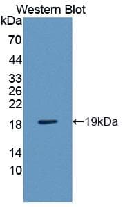 VAPB Antibody (aa1-132, PE)