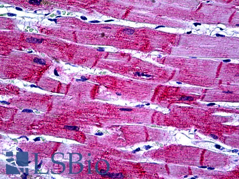 IHC-plus™ Monoclonal Mouse anti-Human HSPB8 / H11 / HSP22 Antibody (clone 5B12, IHC, WB)