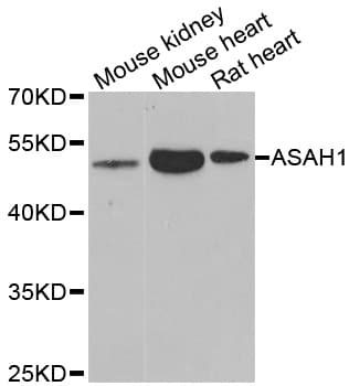 Polyclonal Rabbit anti-Human ASAH1 / Acid Ceramidase Antibody (IHC, WB)