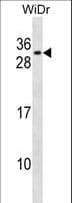 RFXANK Antibody (aa94-123)