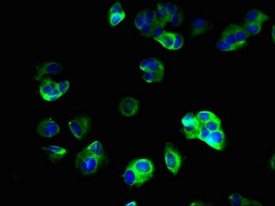 Polyclonal Rabbit anti-Human SV2B Antibody