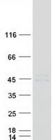 Human CTSL / Cathepsin L Protein (Recombinant Myc-DDK (Flag))