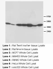 ADRA2A Antibody (C-Terminus, Magnetic beads)
